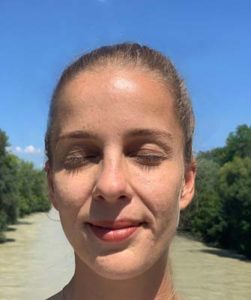 Pigmentflecken im Gesicht